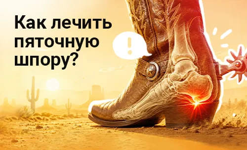Пяточная шпора. Как лечить «ковбойскую» болезнь